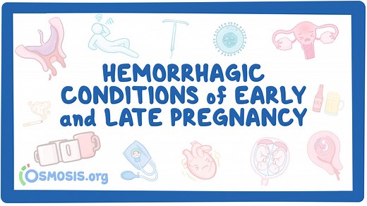 Hemorrhagic Conditions of Early and Late Pregnancy: Video, Causes, & Meaning | Osmosis