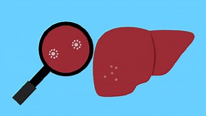 Can Covid vaccines trigger an autoimmune hepatitis in people? Let’s find out