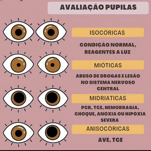 Avaliação Pupilar em Enfermagem: Pupilas Normais e Mióticas Causas