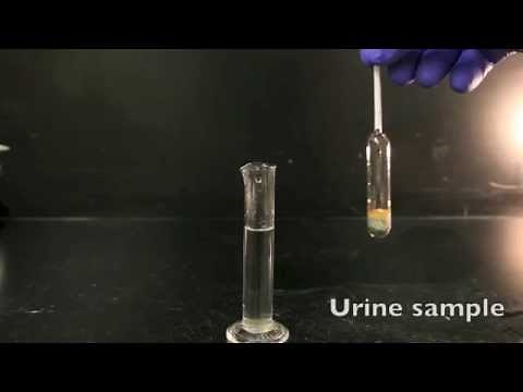 Using a Urinometer