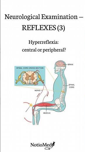 Neurological Reflexes Explained (Hyperreflexia vs Hyporeflexia)