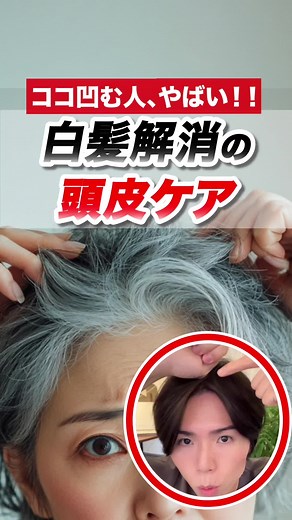ココ凹む人、やばい。死ぬほど白髪が解消 白髪解消の㊙️頭皮ケア