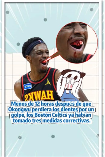 Menos de 12 horas después de que Okongwu perdiera los dientes por un golpe, los Boston Celtics ya habían tomado tres medidas correctivas.