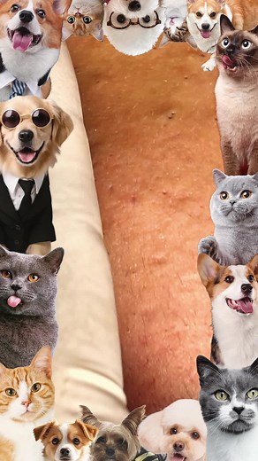 Cyst Popping Video: Ultimate Guide to Blackhead Removal