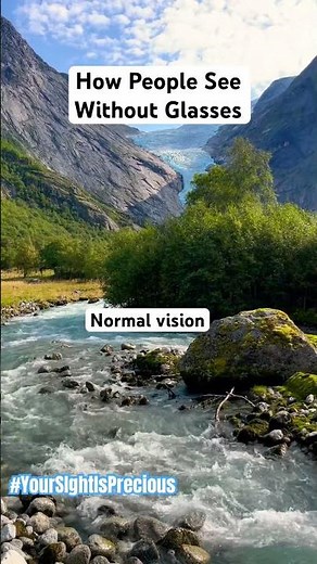 How People See With High Myopia -10.00 #vision-simulation #myopia