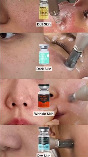 microneeling/derma roller #dermaroller #microneedling #prp #skincareroutine