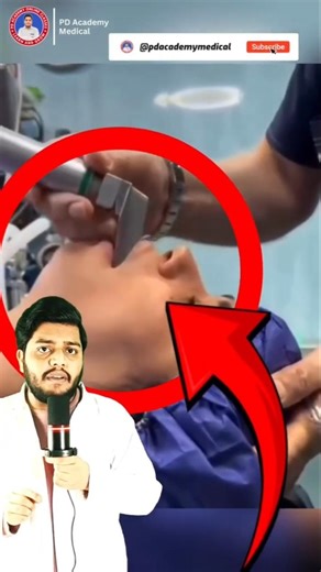 The Procedure That Keeps ICU Patients Alive 😳 #intubation #lifesaving #shorts