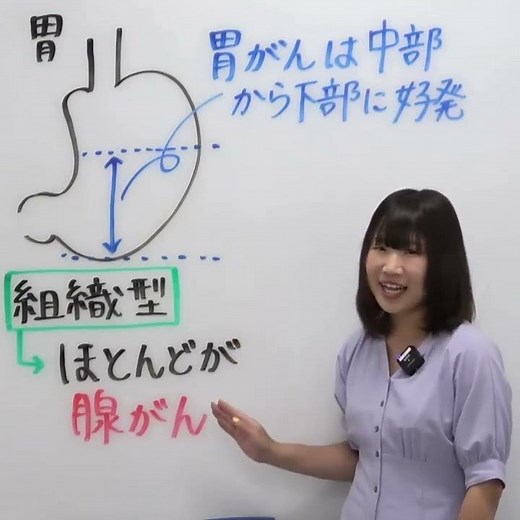 胃癌の組織型では腺癌が多い？ #shorts #受験 #看護国試 #看護師国家試験 #看護師