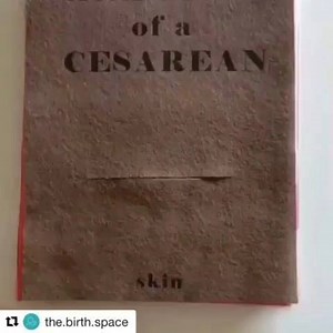 Do you know how many layers are cut when a woman undergoes a csection.... Via the.birth.space #myloappindia #csec #csection #cesareanbirth #momlife #laboranddelivery #delivery #labor #childbirth #mommy #mother #mommyhood #motherhood #momma #mothers | Mylo - Pregnancy & Baby App