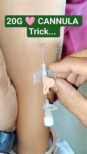Eid Special: IV Cannula Insertion 💉 Pink 20G Trick You Must Know! 🌙✨ #Shorts #trending #medical