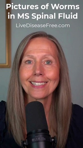 What's Really Causing Multiple Sclerosis and Chronic Neurological Diseases? Prepare to be amazed as Dr. Alan's groundbreaking research reveals game-changing insights into the true origins of multiple sclerosis and other chronic diseases. Brace yourself for a paradigm shift! Dr. Alan is the visionary, the first to identify living parasites within the central nervous system of MS patients at the time of their passing. A groundbreaking discovery that holds the key to unlocking new understanding. By