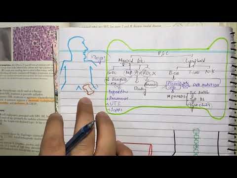 Multiple myeloma 1, pathophysiology, clinical features, diagnosis and treatment