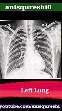 Chest X-Ray PA View Anatomy Explained 🫁📸 | Learn the Basics in Seconds!