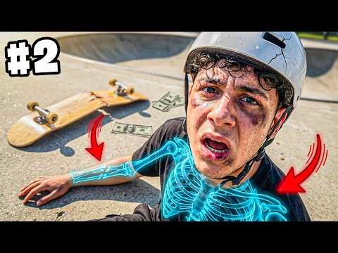 How Many Bones Can I Break While Skateboarding? #2 🦴🛹 | EmirhanCTN