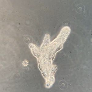Dr. Hunter on Instagram: "Here is an Amoeba moving in Timelapse under the microscope. These large single cells are mesmerizing when sped up. They extend their body to move across the slide. The numerous black dots in the background are bacteria. Collected from a freshwater Florida pond and viewed with 200x phase contrast microscopy, sped 6x real time #amoeba #timelapse #microbe #microbiology #pondlife #freshwater #science #cell #alien #species #micro #small #ecology #protist #protozoa"