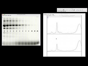 Gel Analysis