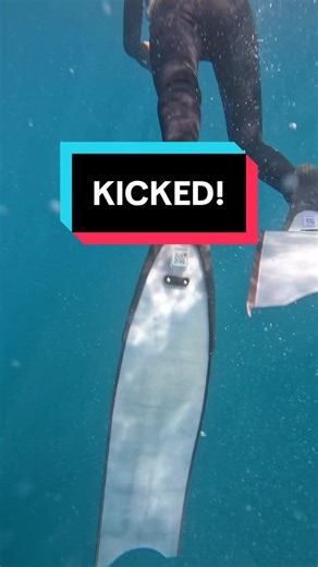 Divers Share Stories About Getting Kicked in the Face