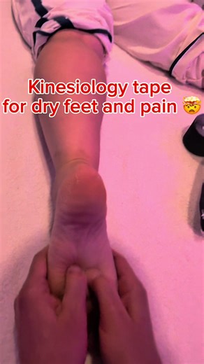 Benefits of Kinesiology Tape for Plantar Fasciitis