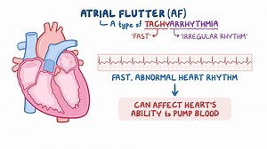 Video: Arrhythmias - Atrial flutter (Aflutter): Nursing - Video Explanation! | Osmosis | Osmosis