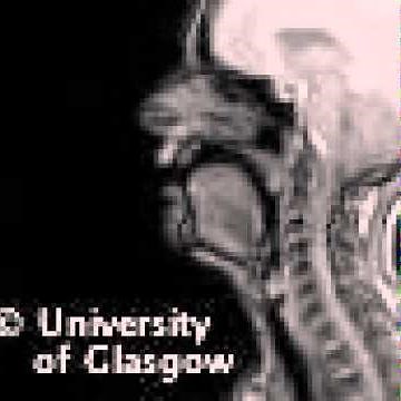 MRI voiceless alveolo-palatal fricative