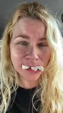 Had all my teeth pulled out just minutes ago