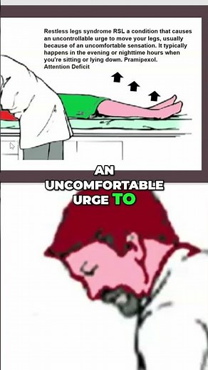 Restless Legs Syndrome: Causes and Pramipexole Treatment #shorts