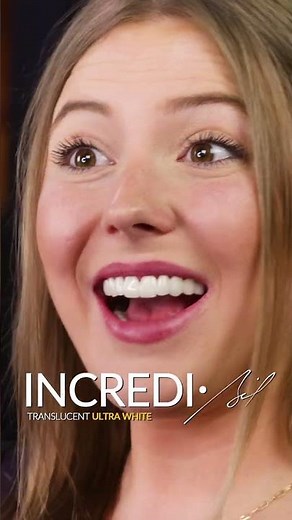 Affordable Snap-On Veneers: The Ultimate Smile Makeover