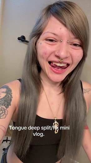 Tongue Deep Split Modification: My Experience and Results