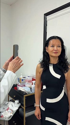 Treating Melasma- Why Pigment Ages You Faster Than Wrinkles #picosure #laserskintreatment #melasma