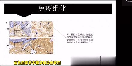 免疫组化图怎么看？一招轻松教你读懂医学文献文献文献阅读 (1)