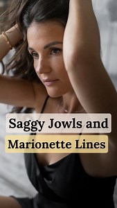 Do you know, saggy jowls and marionette lines are commonly associated with the natural aging process. 😔👴 The decrease in collagen and elastin fibers within the skin’s structure plays a crucial role in their development. 💔 Collagen, the main structural protein responsible for the skin’s firmness and elasticity, gradually declines as we age. 👵 This decline leads to a loss of elasticity, causing the skin to sag and form jowls. 😟🌊 Additionally, as we age, the fat pads in our faces tend to shif