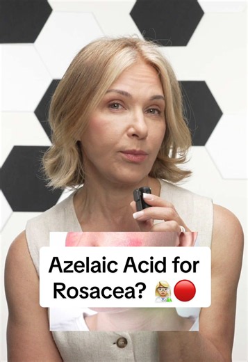 Azelaic Acid for Rosacea: How It Reduces Redness and Bumps