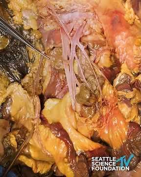 SSF Anatomy. The blood vessels of the mid gut.