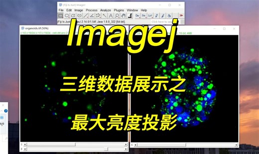 Imagej 三维数据展示之最大亮度投影