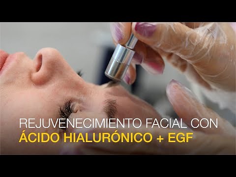 Rejuvenecimiento Facial con Ácido Hialurónico + EGF