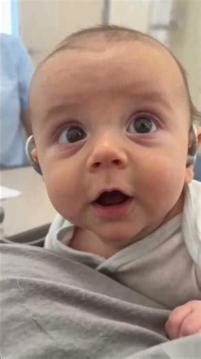 Parents Cry as Baby Reacts To Hearing Device Activation | San Diego Baby Clinic Moment #babyreaction