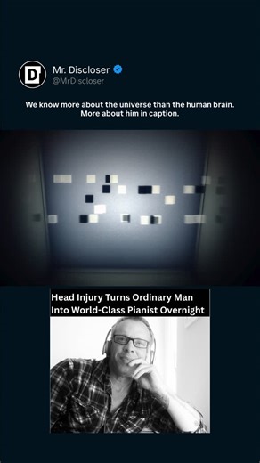 Mr. Discloser | A real neurological anomaly you can verify for yourself. A man with no musical training suffered a head injury-and woke up able to play... | Instagram