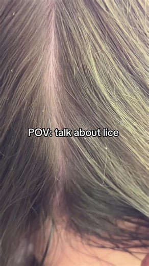 Lice Specialist in Atlanta, GA