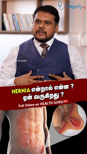 HERNIA என்றால் என்ன? | ஏன் வருகிறது ? | HEALTH GURU #HealthGuru #HerniaTamil #TamilHealthTips #HerniaCauses #MedicalAwarenessTamil #StomachHealth #BodyPainTamil #HealthEducationTamil #WellnessTamil #SurgeryAwareness | Health Guru