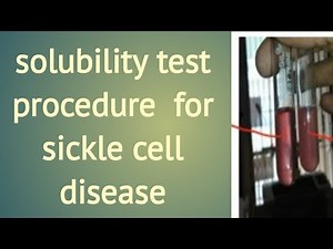 solubility test for sickle cell disease | solubility test procedure
