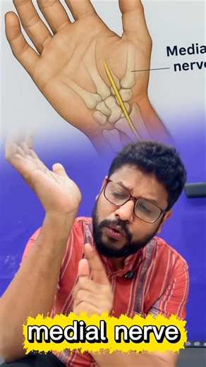 CARC | Carpal tunnel syndrome happens when the median nerve in your wrist becomes compressed 🤏, often due to repetitive hand or wrist movements... | Instagram