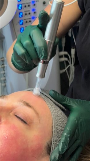 Glow season is here! 🌟 Experience microneedling with the Exceed Candela machine, a medical-grade treatment designed to stimulate collagen production, smooth texture, and firm the skin for a radiant, youthful glow. This November, enjoy 20% off when you book a microneedling lash combo treatment — the perfect pair for refreshed, glowing skin and beautiful lashes! 💆‍♀️💫 #greenhavenspa #facials #esthetician #bellinghamspa #ferndalespa #lashlift #lashextension #spa #microneedling #relax #massage | 