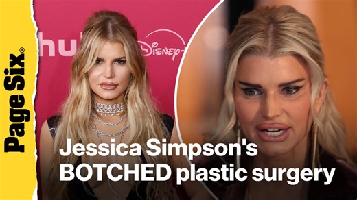 See Jessica Simpson’s jaw-dropping BOTCHED plastic surgery face for her ‘All’s Fair’ acting role