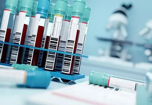 A New Blood Test Can Detect More Than 50 Types Of Cancer