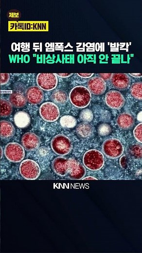 New monkeypox variant discovered, warning against infection after travel to Asia / KNN