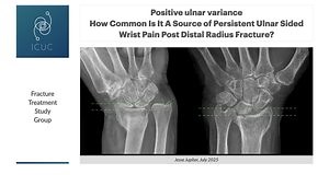Positive Ulnar Variance: How Common Is It a Source of Persistent Ulnar Sided Wrist Pain Post Distal Radius Fracture?