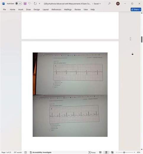 Dysrhythmia Advanced with Measurements Actual Exam Screenshots Exam Questions and Answers #examprep