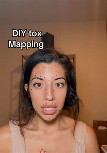 Innotox Facial Mapping Guide for DIY Application