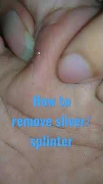 How to remove sliver or splinter