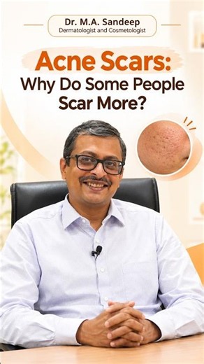 Acne Scars Why Do Some People Scar More Dr Sandeep M A 1